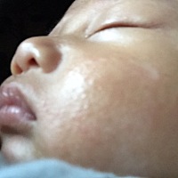 我宝宝脸上的是什么东西。有宝妈有经验的吗？