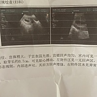 有没有懂的，能看出男孩女孩吗