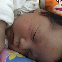 宝宝脸上这种是湿疹吗！感觉越来越多该怎么办呀？