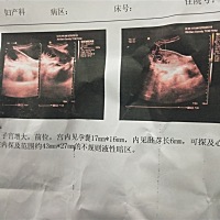 有胚芽有胎心，但是宫腔有血，能保住吗？