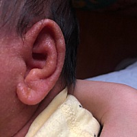 这是第二次了，到底应该怎么办呀，去医院医生就说只是一过性的过敏，但是好担心啊，特别吓人，有没有宝...