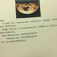 宝妈们九周B超能看出性别吗？