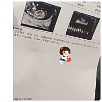 拍个图，传一下！爱你😍！