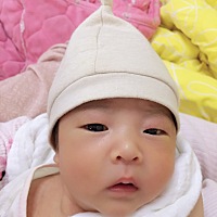 眼皮上的红色还没消，有没有同款宝宝，心塞啊