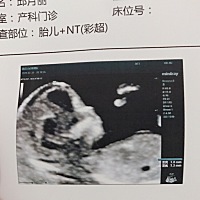 有没有会看男孩还是女孩，挺好奇的