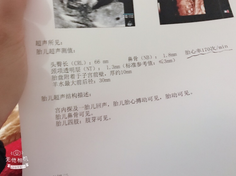 有没有会看男孩还是女孩，挺好奇的