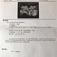 谁能看看是男孩女孩？ 她们说通过胎心率可以看出来