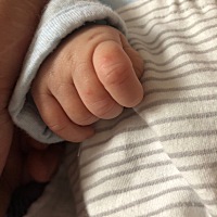 宝宝手上脸上长这种小痘痘，是怎么啦？不多，就几个。