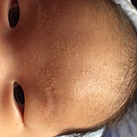 宝妈们请问眉毛旁边这黄色的是什么？要怎么清理呀？