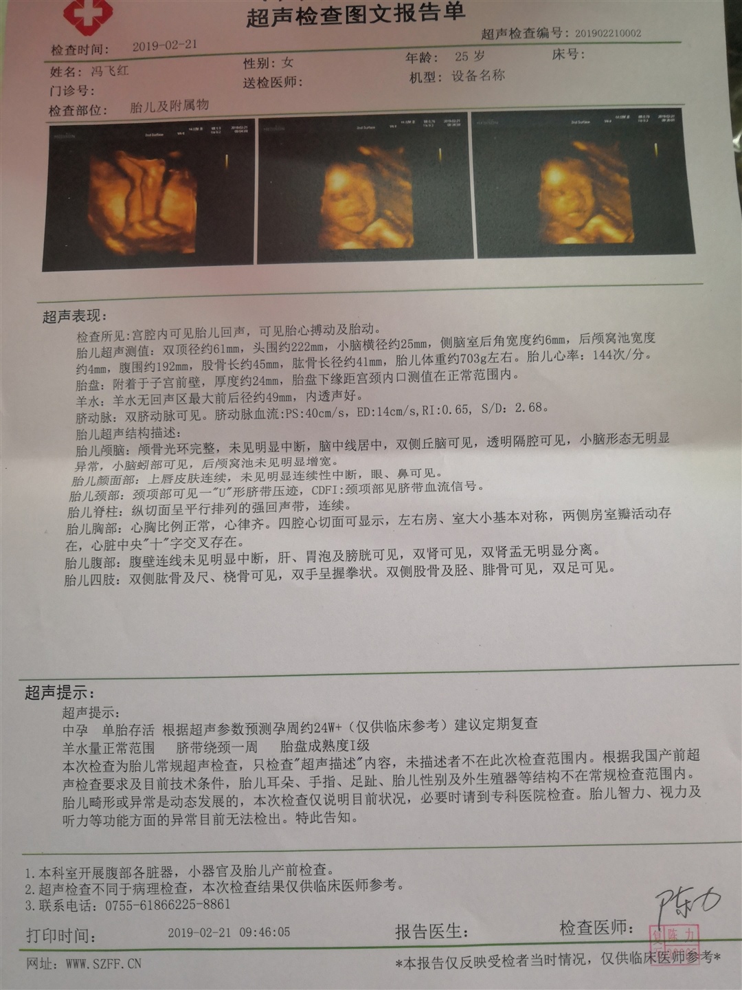 今天四维顺利通过好开心😘祝愿所有孕妈的孕检躲一次性通过哦，有谁会看男女的帮忙看下哈😊