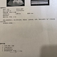 NT值2.4MM， 医生说有点厚了，建议直接无创、有点担心呀，你们的NT值是多少？？ 还有现在可以看出男孩 ...
