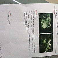 有优势卵泡，加油💪