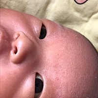 一个月的宝宝脸上起痘痘怎么回事