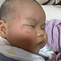 有没有类似情况的宝宝，总是抓脸，指甲剪的很短了，抓的脸，我看着都心疼，怎么处理