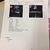 曾经我以为自己的宝宝体重不轻呢 结果38+2周生下来才六斤 什么双顶径X900–5200 什么胎儿体重器都不准