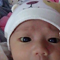 都满月了，为什么黄疸还没退下去？连眼睛都是黄的？你们的宝宝都多长时间退下去的呢？求经验的宝妈给点...
