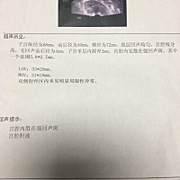 刨腹产四五十天了 今天去检查子宫还有东西 好怕清宫 有没有宝妈和我一样 后来没有清宫的