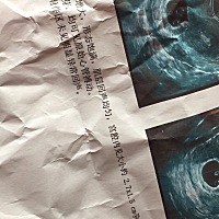 惊喜还是惊吓，祝福宝宝健康成长