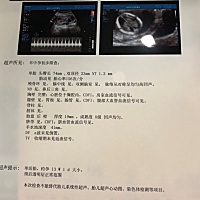 做四次nt，小🐷太难为老母亲我了