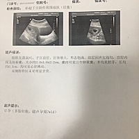 抢地主 不抢 不抢 你们三个不孤单