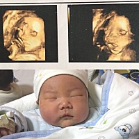 二胎顺产七斤小妞一枚，跟四维照片不怎么像！以为是男宝宝，结果是女娃娃。