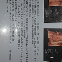 可以看出是男孩还是女孩吗