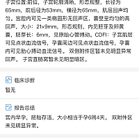 为什么我们这边孕囊数据只有两个数？想猜男女玩一下都猜不出。