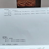 双胎12周了，准备过几天去做nt，希望一切顺利🙏🙏🙏