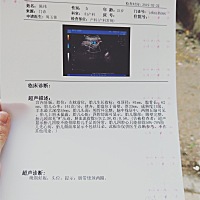 33周 1脐带绕颈两圈，请问严重吗？