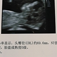 大家帮我看看今早做的nt进去到处来才2分钟