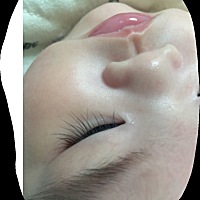 宝宝长倒睫 宝宝眼角长睫毛，要紧吗，你们宝宝有长过吗