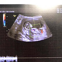 国外流行用NT来判断男女，大家帮我看看小蓝还是小粉呀