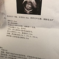 38周B超 多重