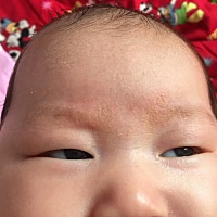 有谁知道孩子眼眉间长的什么吗