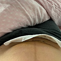 那么大一个医院竟然不用美容线，还要拆线，我是非常害怕，不知道疼不疼，以后不想来这医院了，麻醉过了...