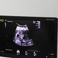 各位宝妈谁能帮着看看是男娃儿还是女娃！