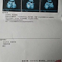 这怎么看男孩女孩啊😊