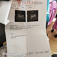 月经推迟15天，自己测阳性，今天去医院做了b超，医生说没有看到孕囊，血检结果还没有出来，好闹心