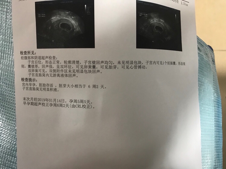 躺在B超室紧张到抖动，结果喜极而泣。
一关一关，我们一起闯呢！