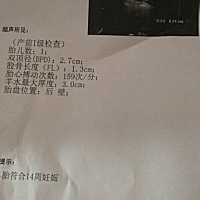 胎盘位置是不是就是说孩子朝后啊 对吗孕妈嘛 到底是什么意思啊 求孕妈指点啊