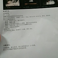 NT顺利通过😁哪位大神帮我看看是男是女，只是好奇