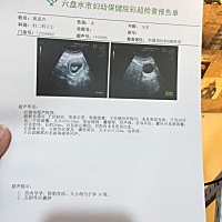 帮忙看一下这是一个宝宝还是两个？左附件囊肿会影响宝宝吗？