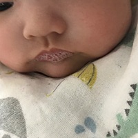 宝宝醒着就吐泡泡，喉咙还有痰音，不发烧，咳嗽只是偶尔，一天差不多听到三四声咳嗽。精神也还不错，白...