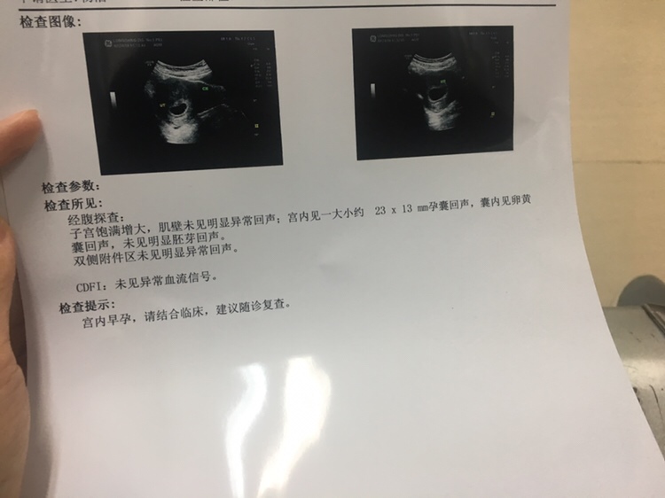 末次月经12月20号，半个月检查还没胎心，今天检查也还看不到胎心，有宝妈遇到过这样的情况吗。。。。。