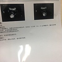 末次月经12月20号，半个月检查还没胎心，今天检查也还看不到胎心，有宝妈遇到过这样的情况吗。。。。。