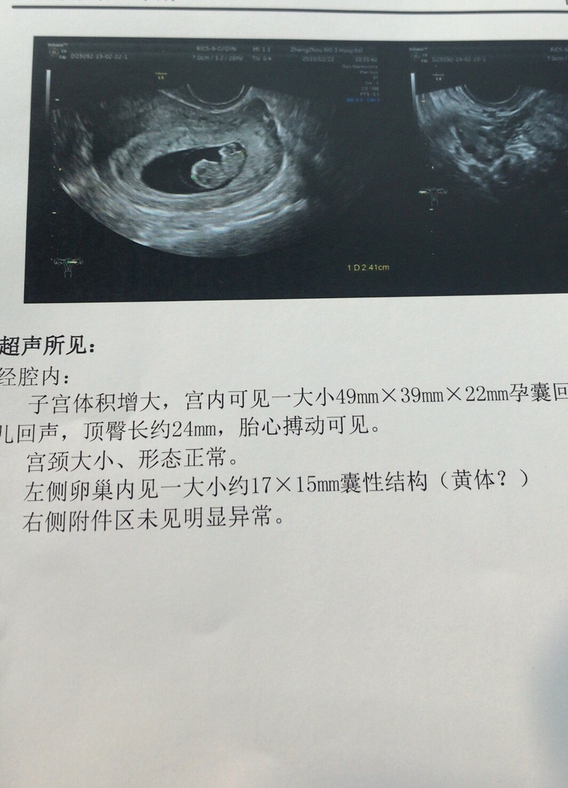 能不能看出男孩女孩