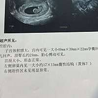 能不能看出男孩女孩
