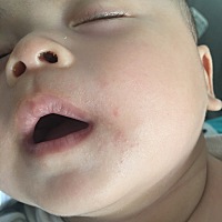 各位宝妈有人知道我儿子嘴角是什么吗？新给他买了个咬咬胶，是吃那个吃的么？还是口水疹？