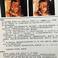四维一次过 宝宝有点给力哦