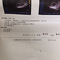 怀孕7周、1月2号的月经。 第一次做B超、听见胎心。 可是宫腔积液、这个怎么办？ 有没有同样的孕妈妈！